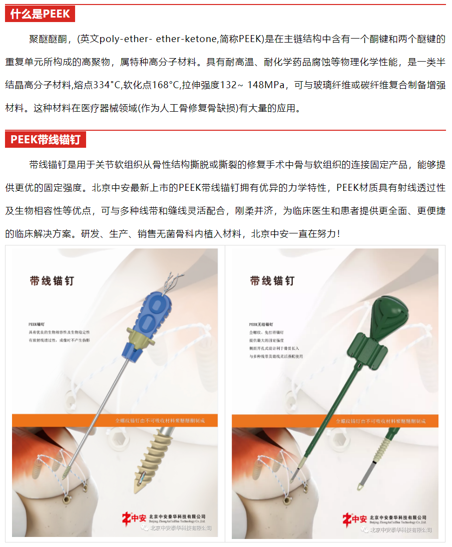 中安|北京中安|北京中安泰華科技有限公司|3D打印與定制|關(guān)節(jié)|脊柱|創(chuàng)傷|運(yùn)動醫(yī)學(xué)|微創(chuàng)|外固定支架|全系列產(chǎn)品|全滅菌包裝