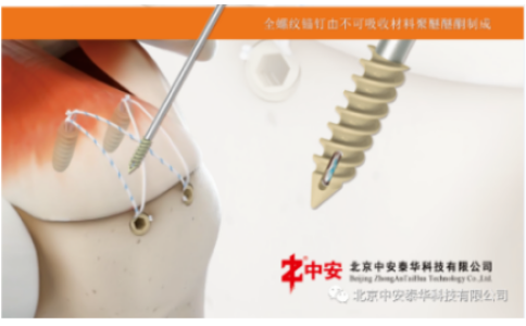 喜報！北京中安取得“聚醚醚酮帶線錨釘”注冊證！
